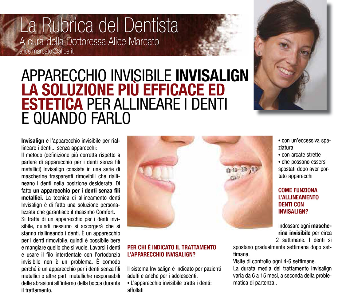 Invisalign apparecchio invisibile a Padova